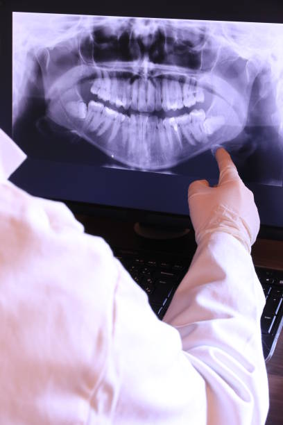 Best Dental Abscess Treatment in Cornersville, TN