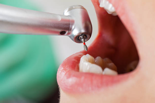 Best Urgent Dental Care for Toothaches in Cornersville, TN
